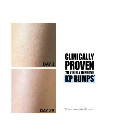 THE INKEY LIST Glycolic Acid Exfoliating Body Stick - Buy Online on GoSupps.com