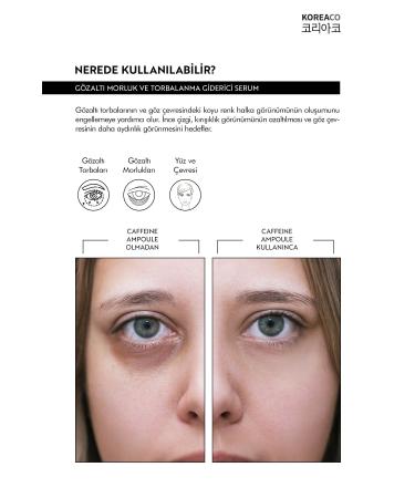 KOREACO Effective Against Under-Eye Bags and Dark Circles Intensive Moisturizing Serum 50 Ml - Renewing - Buy Online on GoSupps.com