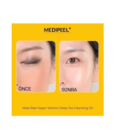 Medipeel Vegan Vitamin Deep-tox Cleansing Oil 200 ml - Buy Online on GoSupps.com