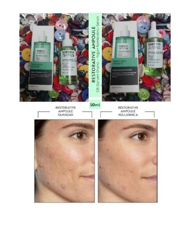 KOREACO SKIN BARRIER REPAIRING REGENERATING CARE SERUM 50 ML. - Buy Online on GoSupps.com