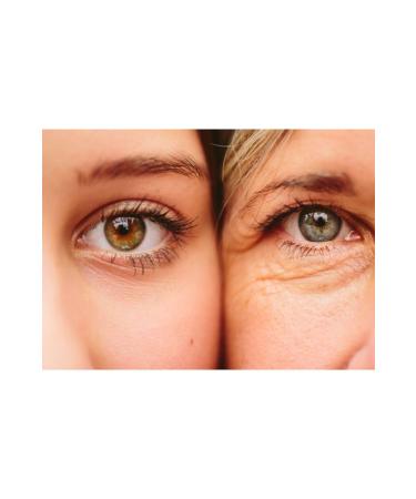 Revolution Skincare Vegan - Under Eye Serum 5% Caffeine Solution + Hyaluronic Support Serum-30 ml - Buy Online on GoSupps.com