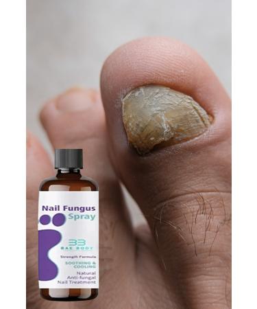 baebody Eliminator & Deep Treatment & Advanced Antifungal Serum & Large Size - Buy Online on GoSupps.com