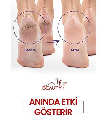 Miya Beauty Softening Foot Care Cream - Whitening Effective Fungal Nail Heel Crack Care 150 ml - Buy Online on GoSupps.com