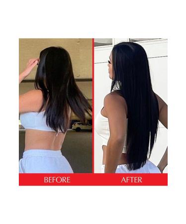 HAIRtamin 10 Scalp Serum - Buy Online on GoSupps.com