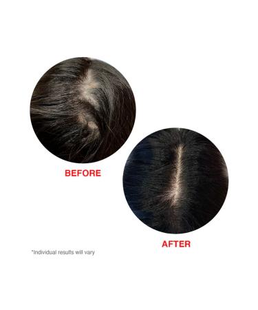 HAIRtamin Scalp Serum - Buy Online on GoSupps.com