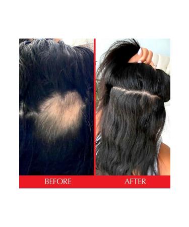 HAIRtamin 10 Scalp Serum - Buy Online on GoSupps.com