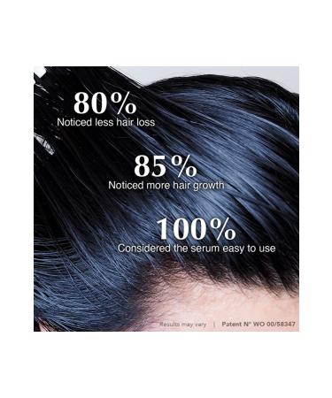 HAIRtamin Scalp Serum - Buy Online on GoSupps.com