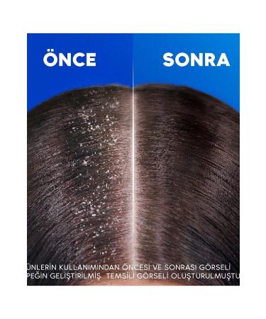 Head & Shoulder Head & Shoulders Men's Anti-Hair Loss 2 in 1 Shampoo 330 ml - Buy Online on GoSupps.com