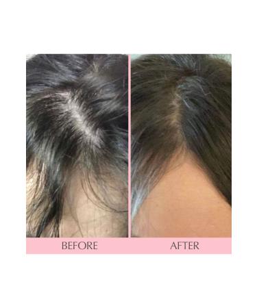 HAIRtamin Advanced Formula - Buy Online on GoSupps.com