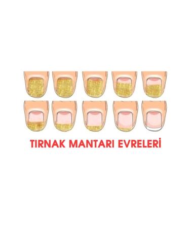 Cabs Nail Care and Foot Cream - Nail Fungus Prevention Lotion Drops - Buy Online on GoSupps.com