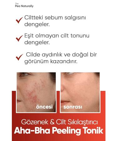 The Pea Naturally Pore & Skin Tightening Aha & Bha Peeling Tonic 200 ml - Buy Online on GoSupps.com