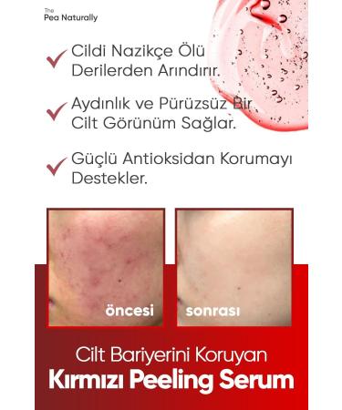 The Pea Naturally Skin Renewal & Skin Tone Equalizer Red Peeling Serum (aha 0 Bha 2%) 30 Ml - Buy Online on GoSupps.com