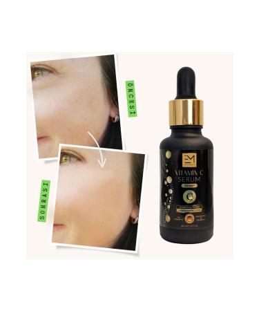 EM AMANOS BEAUTY Vitamin C Serum-30 ml - Buy Online on GoSupps.com