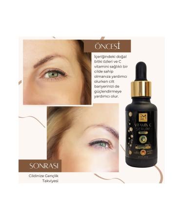 EM AMANOS BEAUTY Vitamin C Serum-30 ml - Buy Online on GoSupps.com