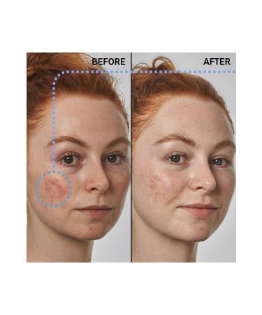 THE INKEY LIST Redness Solution with 10% Azelaic -Anti-Redness Soothing Azelaic Acid Serum 30ML - Buy Online on GoSupps.com