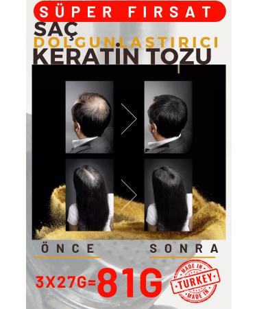 ME PROFESSIONAL 81GR BLACK Hair Thickening Keratin Fibers Topical Hair Powder Hair Concealer Hair Fiber Barber - Buy Online on GoSupps.com