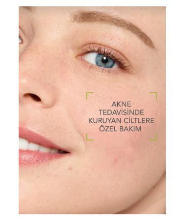 Hanuva Anti-Acne and Blackhead Remover Cream Anti-Acne Skin Cleansing Acne Cream 50ml - Buy Online on GoSupps.com