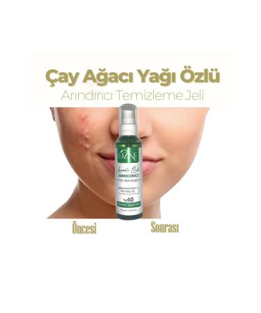 Ozne Lavender Essence Purifying Face Wash Gel 150ml