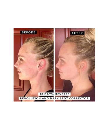 Revolution Skincare Dark Spot Corrector Vegan Cruelty Free Serum 30 Ml - Buy Online on GoSupps.com