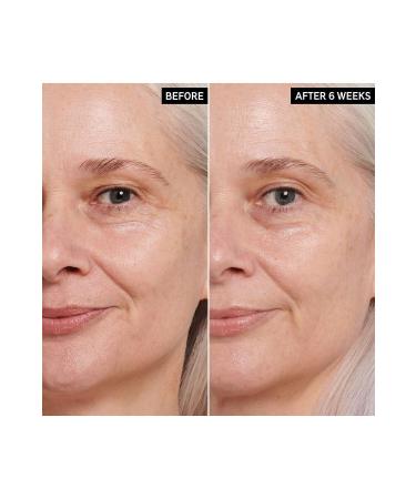 THE INKEY LIST Retinol Eye Cream - Fine Line Eye Cream 15 ML - Buy Online on GoSupps.com