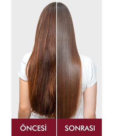 Swissoderm Anti-Hair Loss Shampoo Oily Hair Vegan Fast Growth Sulfate-Free Salt-Free Against Hair Loss 300ml - Buy Online on GoSupps.com