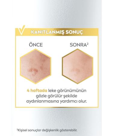 NIVEA Luminous630 Anti-Spot Brightening Skin Care Serum 30ml Hyaluronic Acid Skin Tone Equalizer - Buy Online on GoSupps.com