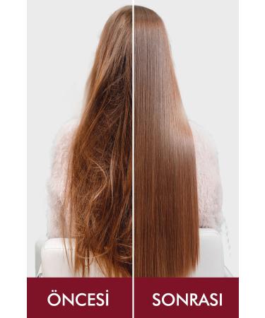 Swissoderm Anti-Hair Loss Shampoo Normal & Dry Hair Fast Growth Sulfate-Free Salt-Free Anti-Hair Loss 300ml - Buy Online on GoSupps.com