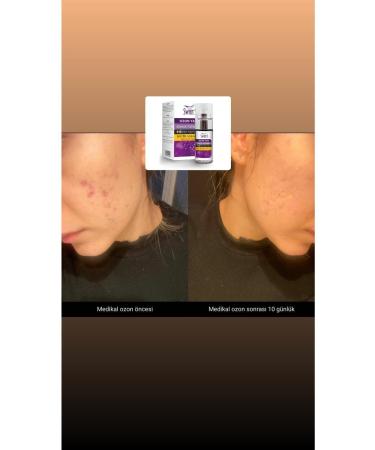 Swans Ozone Oil-Daily Facial Care(50spf) - Buy Online on GoSupps.com