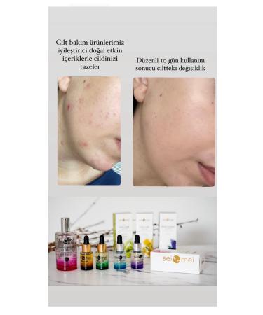 Sei Mei Seimei 24 K Skin Care Oil Gold Particle Skin Care Oil (Skin Care Serum) - Buy Online on GoSupps.com