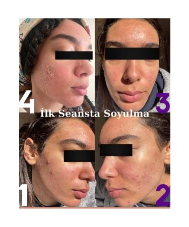 DR.ALGLER Algae Peeling Professional 5 Uses - Buy Online on GoSupps.com