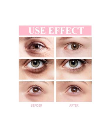 Beauty Box Under Eye Care Cream for Eye Swelling and Dark Circles Eye Fatigue Anti-Wrinkle 50ml - Buy Online on GoSupps.com