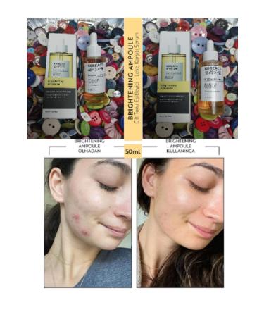 KOREACO BRIGHTENING AMPOULE ANTI-SPOT AND SKIN TONE BRIGHTENING SERUM 50ml - Buy Online on GoSupps.com
