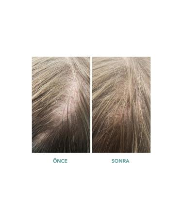 We Are Paradoxx Growth Advanced Scalp Serum - Hair Serum That Supports Hair Growth & Prevents Hair Loss - Buy Online on GoSupps.com