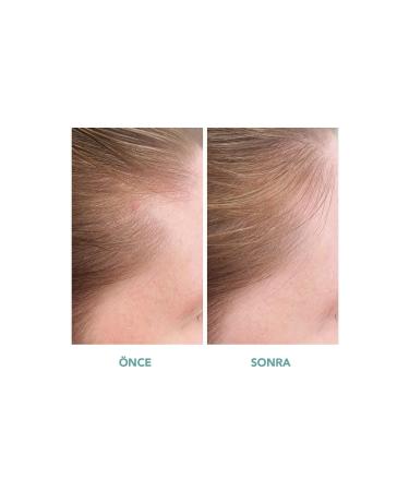 We Are Paradoxx Growth Advanced Scalp Serum - Hair Serum That Supports Hair Growth & Prevents Hair Loss - Buy Online on GoSupps.com