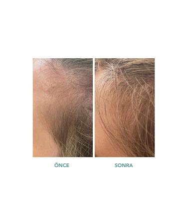 We Are Paradoxx Growth Advanced Scalp Serum - Hair Serum That Supports Hair Growth & Prevents Hair Loss - Buy Online on GoSupps.com