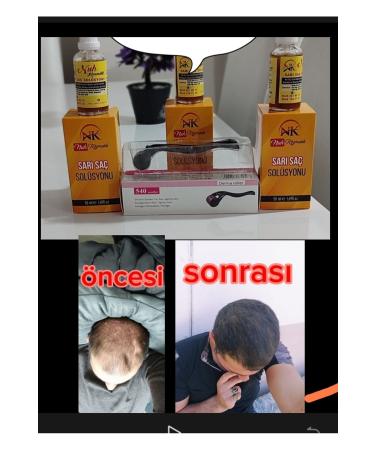 NUH Blonde hair solution