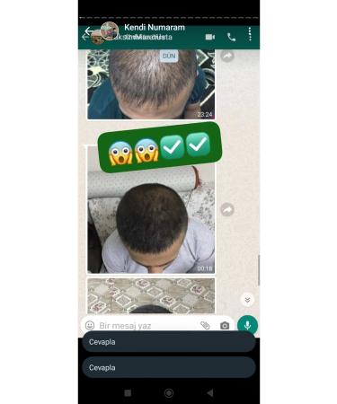 NUH Blonde hair solution - Buy Online on GoSupps.com