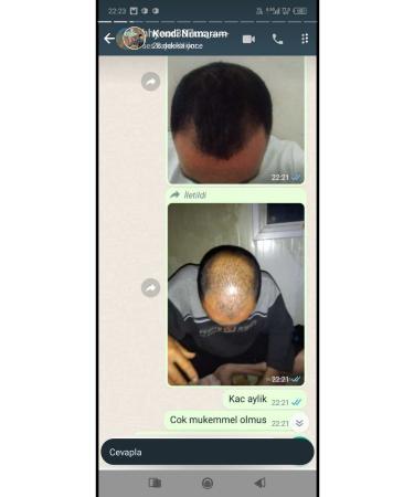 NUH Blonde hair solution - Buy Online on GoSupps.com
