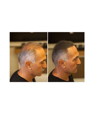 FIXPLANT Hair Plumping Topic 28 Gr. - Medium Brown - Buy Online on GoSupps.com