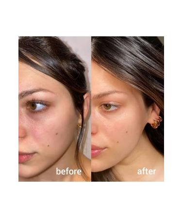 Beauty Box Eye Contour and Lip High Energy Medical Care Cream Against Eye Fatigue and Wrinkles 10ml - Buy Online on GoSupps.com