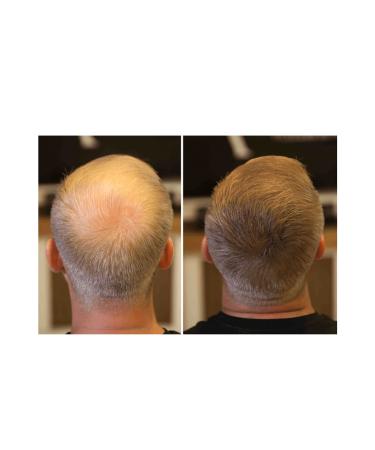 FIXPLANT Hair Volumizer 2 Bottles Topik 56 Gr. | Hair Powder for Thin Hair | Hair Fiber - Buy Online on GoSupps.com