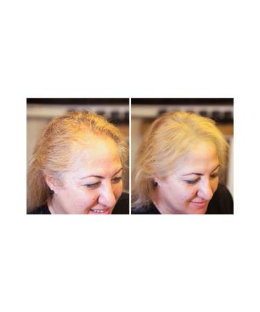 Fixdeep New Generation Hair Volumizing Powder 14 Gr. | Hair Fiber for Thin Hair | Fixdeep Water-proof - Buy Online on GoSupps.com