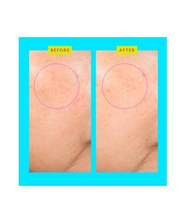 Drunk Elephant Bouncy Brightfacial - Anti-Spot Purifying Face Mask with Salicylic & Azelaic Acid 50ML - Buy Online on GoSupps.com