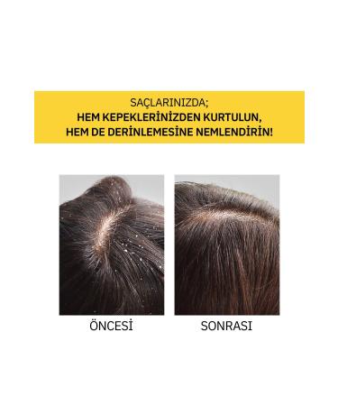 Thalia Piroctone Olamine Anti-Dandruff Hair Care Shampoo 400ml - Buy Online on GoSupps.com