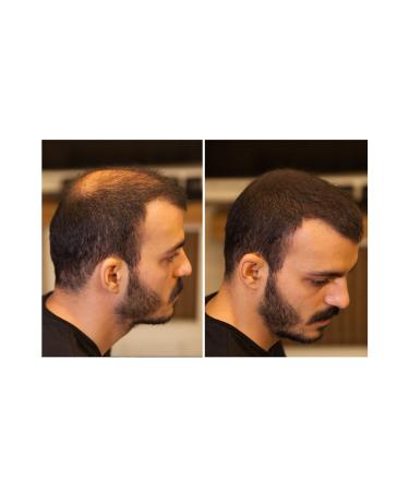 Fixdeep New Generation Hair Volumizing Powder 14 Gr. | Hair Fiber for Thin Hair | Fixdeep Water-proof - Buy Online on GoSupps.com