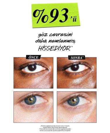 Kiehl's CREAMY EYE TREATMENT AVOCADO INTENSE MOISTURIZING EYE CREAM 14 ML PSSN3724 - Buy Online on GoSupps.com