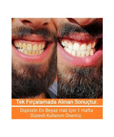 Diamond Dental Teeth Whitening and Polishing Cream 80 Gr. - Buy Online on GoSupps.com