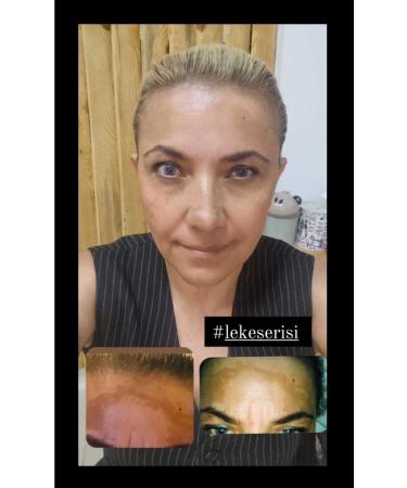 G n l nl Stain Series 3 Pack - Buy Online on GoSupps.com