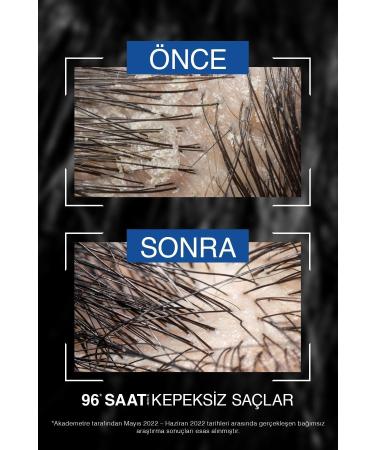 Bioblas Thermal Expert Men Anti-Dandruff Shampoo 360 ml - Buy Online on GoSupps.com