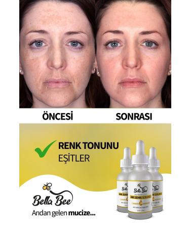 BELLA BEE Bee Venom Anti-aging and Face Care Serum - Buy Online on GoSupps.com